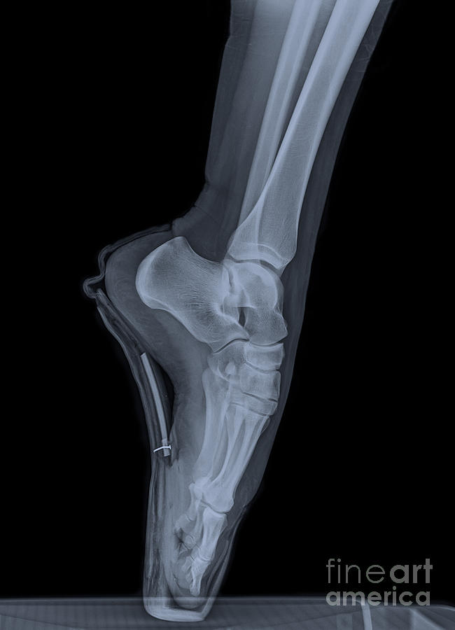 Ballet Dancer x-ray 2 Photograph by Guy Viner