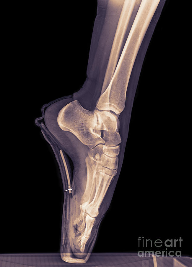 Ballet Dancer x-ray 3 Photograph by Guy Viner
