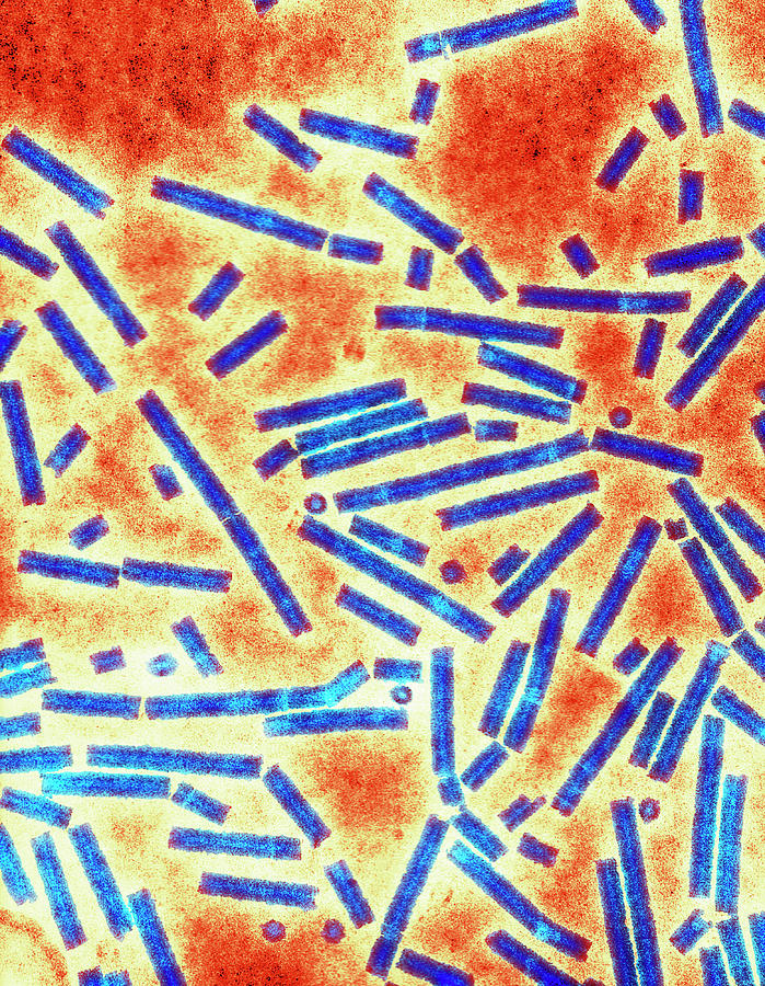 Barley Stripe Mosaic Virus Photograph by Science Photo Library Barley Stripe Mosaic Virus Photograph by Science Photo Library