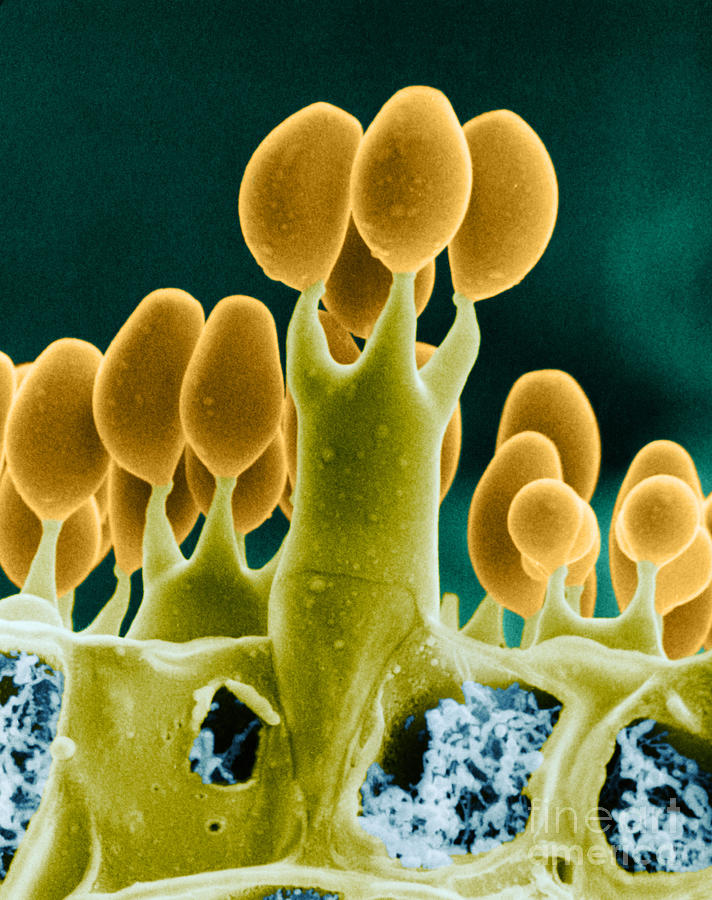Basidiomycota Sem Photograph by Biophoto Associates