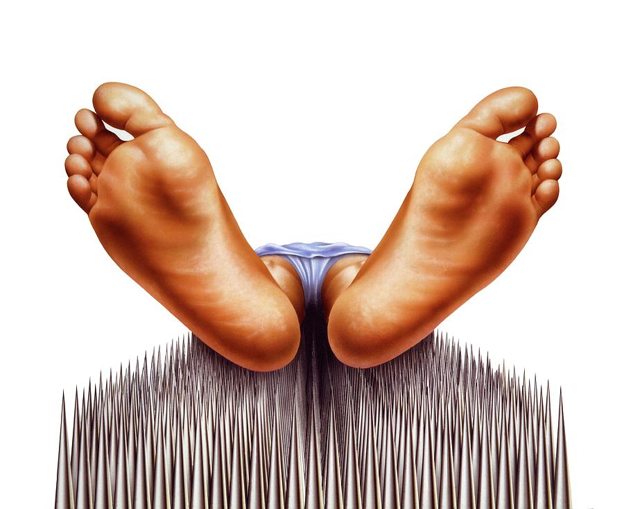 Bed Of Nails Photograph by Leonello Calvetti/science Photo Library
