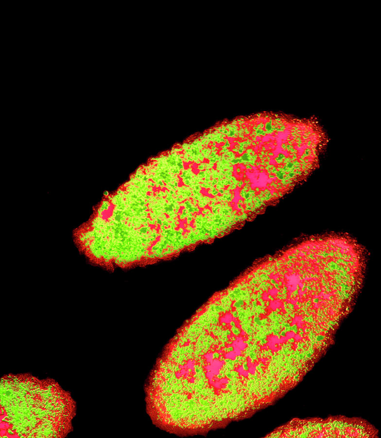 Bilophila Wadsworthia Bacteria Photograph By Dr Kari Lounatmaa Science