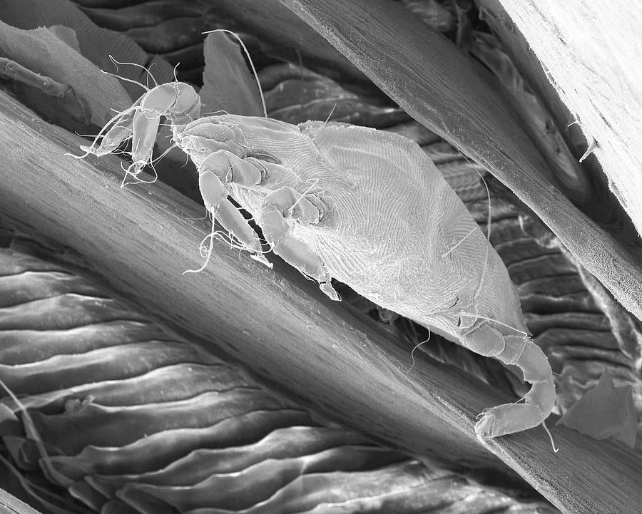 Bird Mite Between Feather Barbs Photograph by Dennis Kunkel Microscopy/science Photo Library