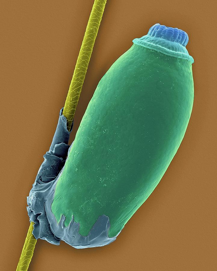 Biting Louse Egg Case Photograph by Dennis Kunkel Microscopy/science ...