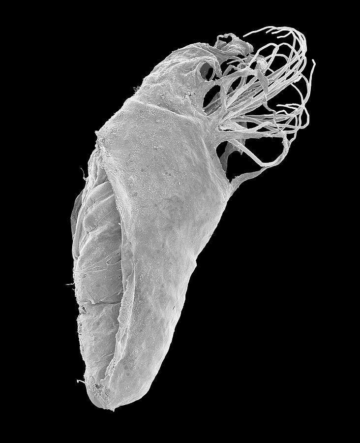 Black Fly Pupa Photograph by Dennis Kunkel Microscopy/science Photo Library