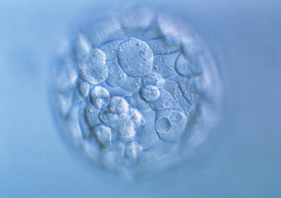 Blastocyst Embryo Photograph by Pascal Goetgheluck/science Photo Library