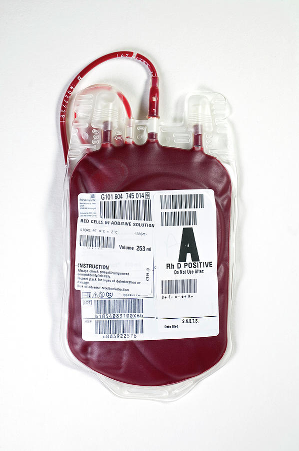 hiv-and-blood-transfusions