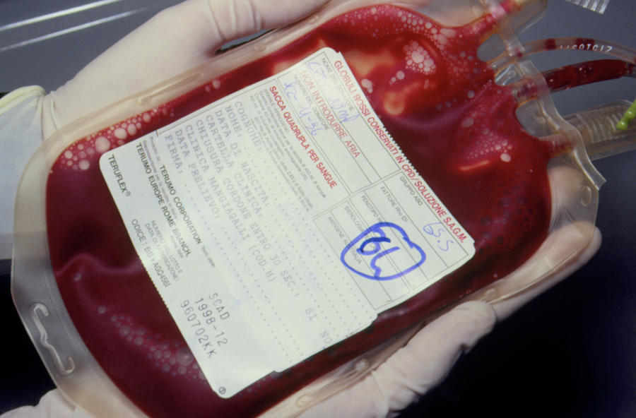 Blood Bag Containing Umbilical Cord Blood Photograph by Klaus Guldbrandsen/science Photo Library