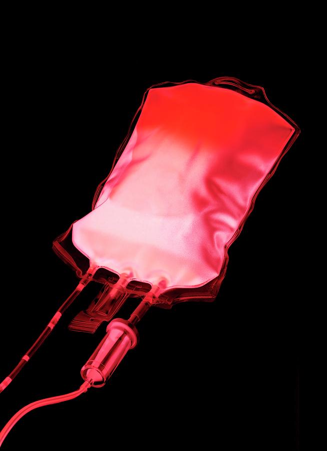 Blood Bag Photograph by Science Photo Library - Fine Art America