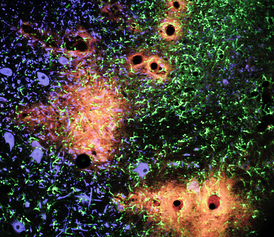 Blood-brain Barrier Breakdown Photograph by C.j.guerin, Phd, Mrc Toxicology Unit/ Science Photo Library