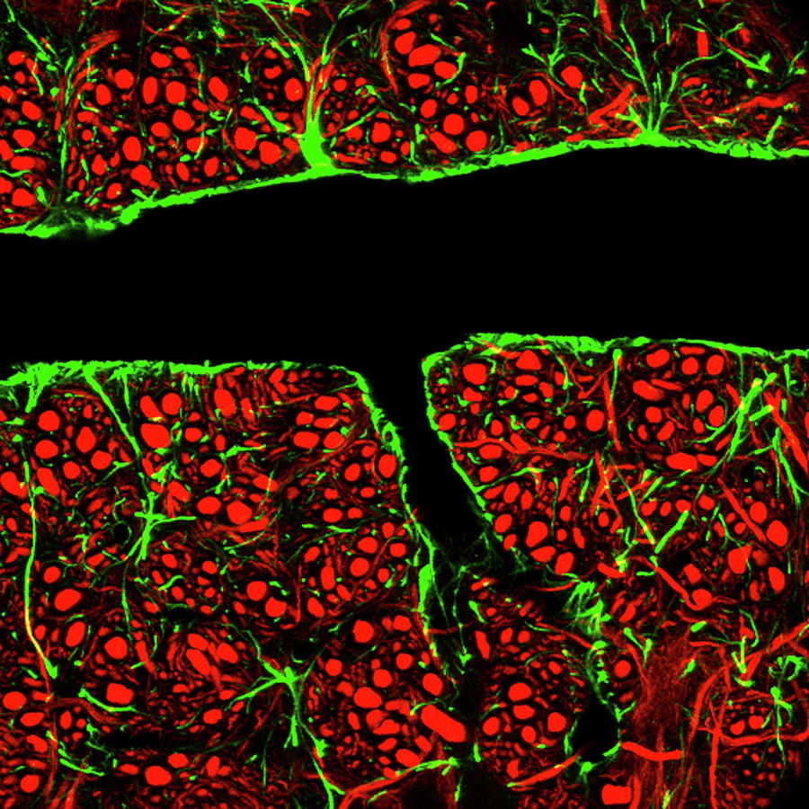 Blood-brain Barrier Photograph by C.j.guerin, Phd, Mrc Toxicology Unit/ Science Photo Library