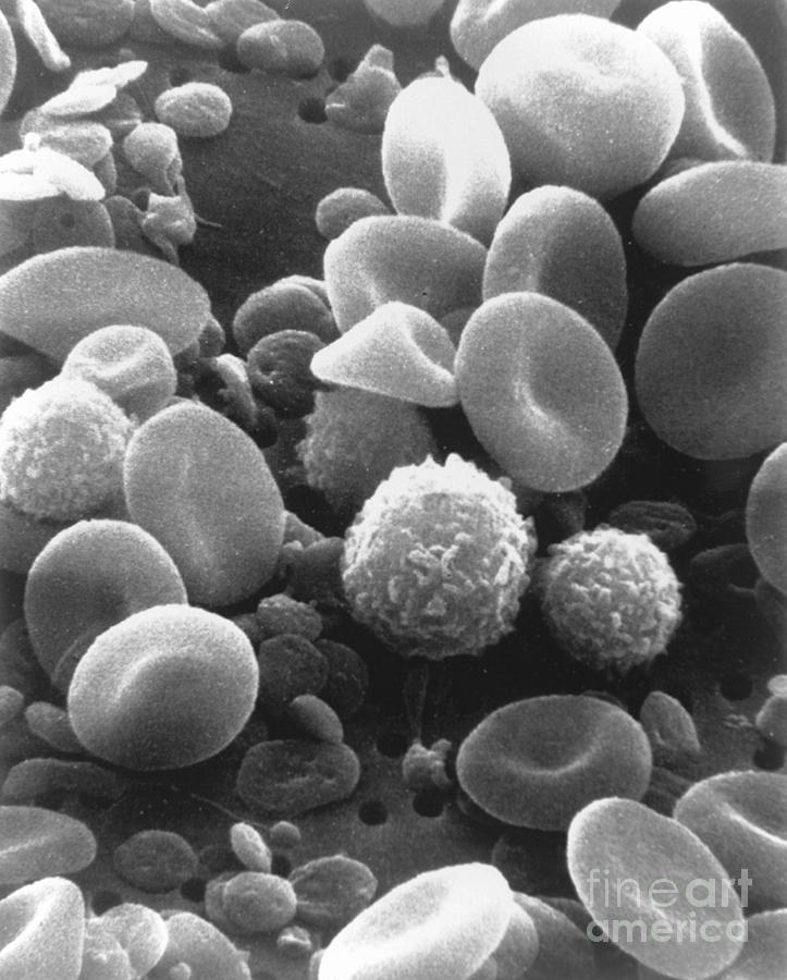 Blood Cells And Platelets Photograph by Science Source