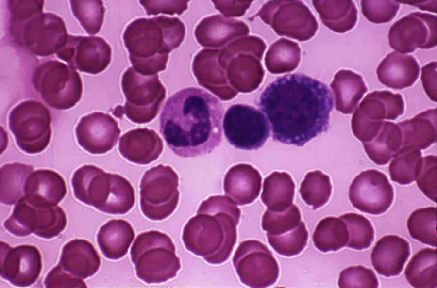 Blood Cells Photograph by Steve Allen/science Photo Library