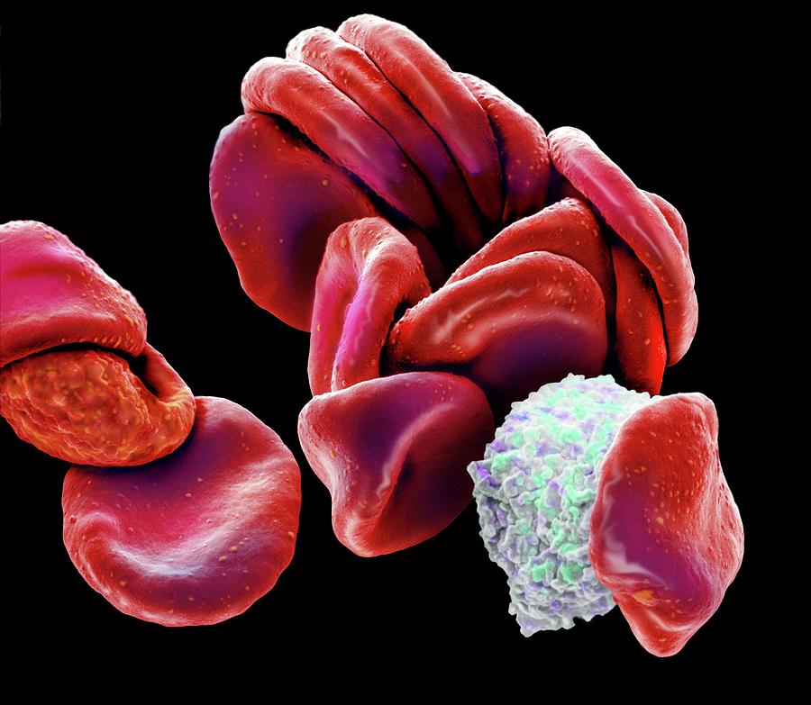 Blood Cells Photograph by Steve Gschmeissner/science Photo Library