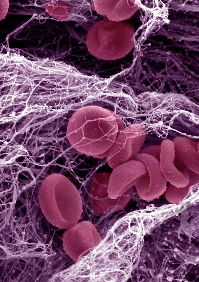 Клетки сил. Тромб микрофотография. Красный тромб микрофотографии. ДНК под электронным микроскопом.