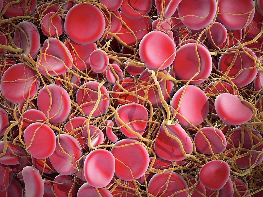 Erythrocyte Photograph - Blood Clot by Maurizio De Angelis