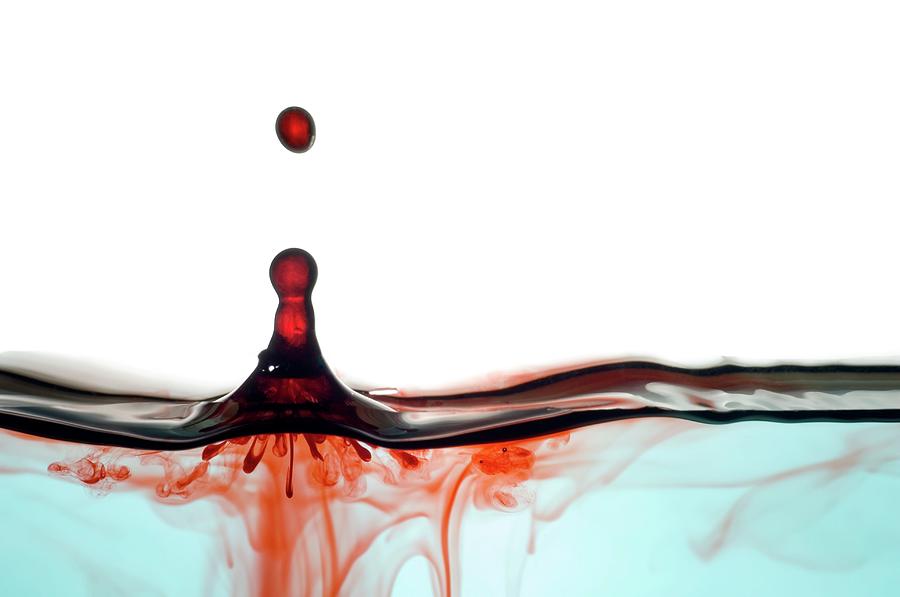 Blood Dripping Photograph by Daniel Sambraus/science Photo Library