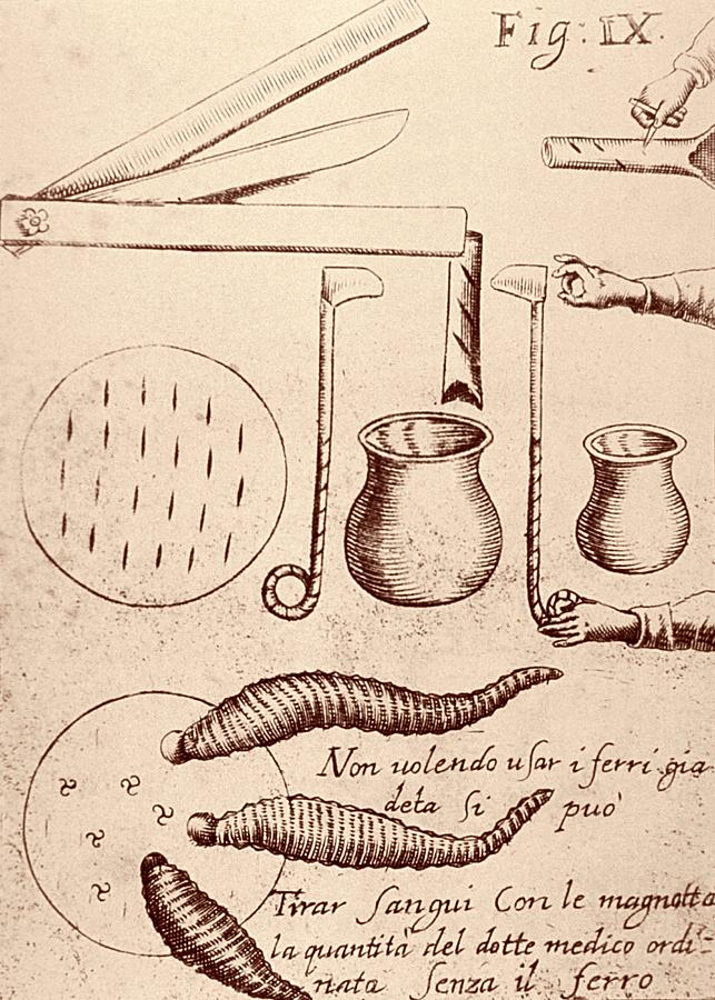 Bloodletting Instruments Photograph by National Library Of Medicine