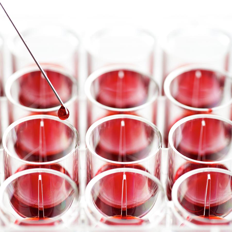 Blood Sample And Multiwell Tray Photograph by Science Photo Library