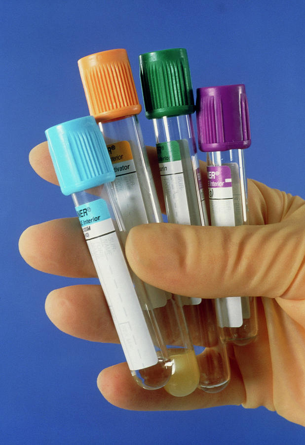 Blood Sample Bottles Photograph By Claire Paxton Jacqui Farrow Science Photo Library