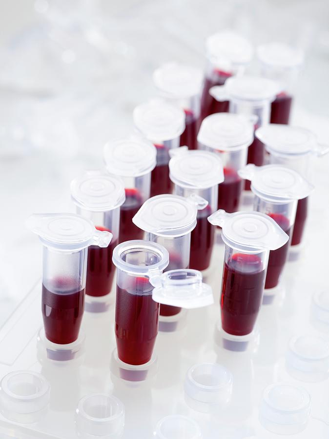 Nobody Photograph - Blood Samples In Centrifuge Tubes by Science Photo Library