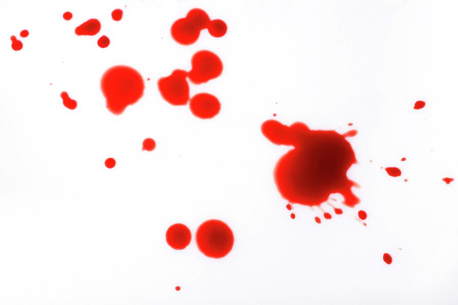 Blood Spatter Photograph by Cordelia Molloy