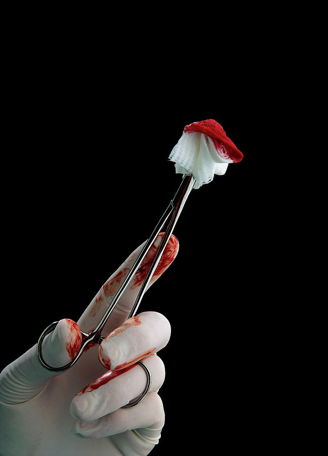 Blood-stained Gauze Held In Scissor Forceps Photograph by Saturn Stills/science Photo Library