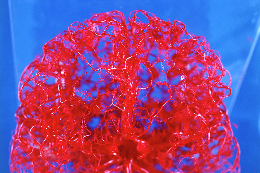 Blood Supply To The Human Brain Photograph by Science Photo Library