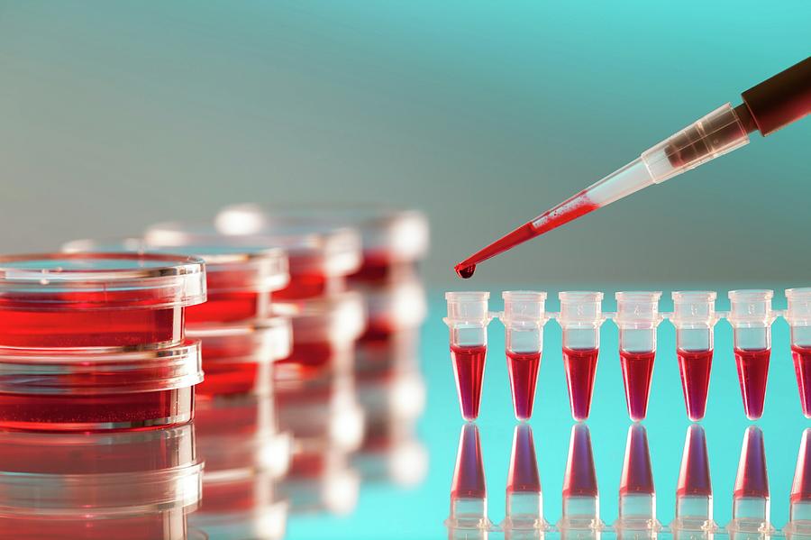 Blood Testing Photograph By Wladimir Bulgar