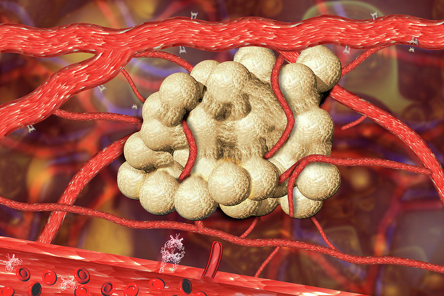 Blood Vessel Formation Photograph by Carol & Mike Werner/science Photo Library