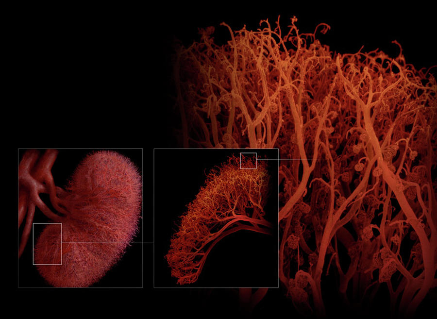 Blood Vessels Of The Kidney Photograph by Anatomical Travelogue