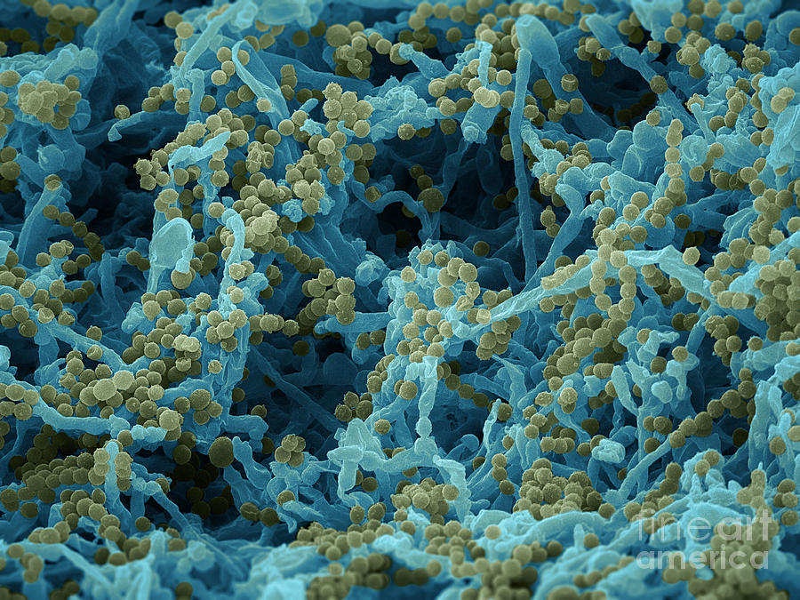 Cheese Photograph - Blue Cheese Sem by Ted Kinsman