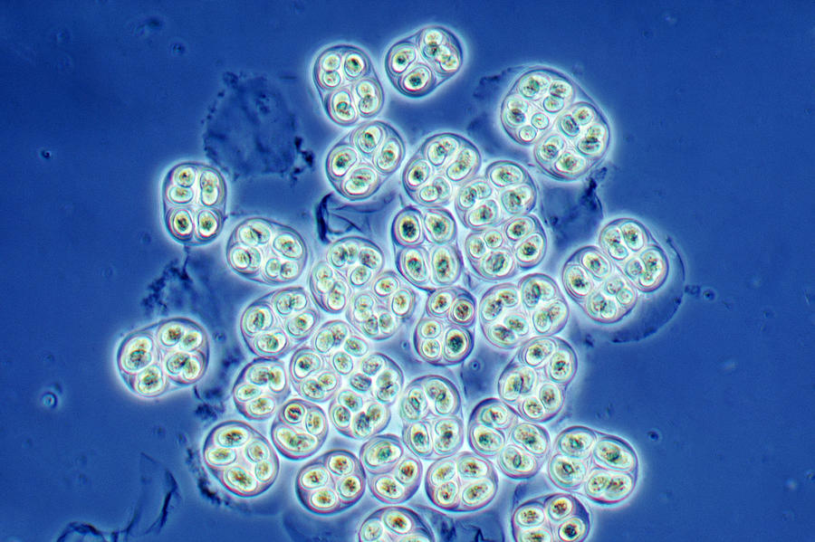 Blue-green Algae Photograph by Biology Pics
