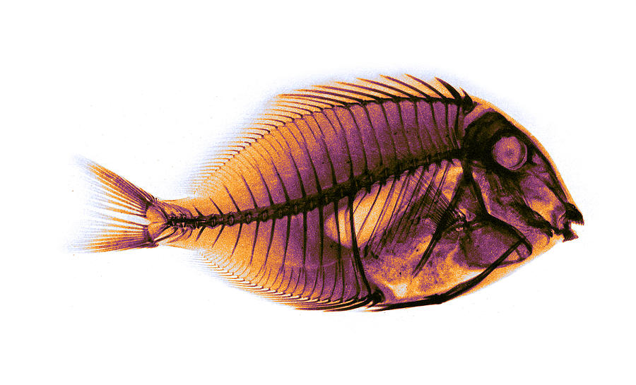 Bluelined Surgeonfish, X-ray, 1896 Photograph by Science Source