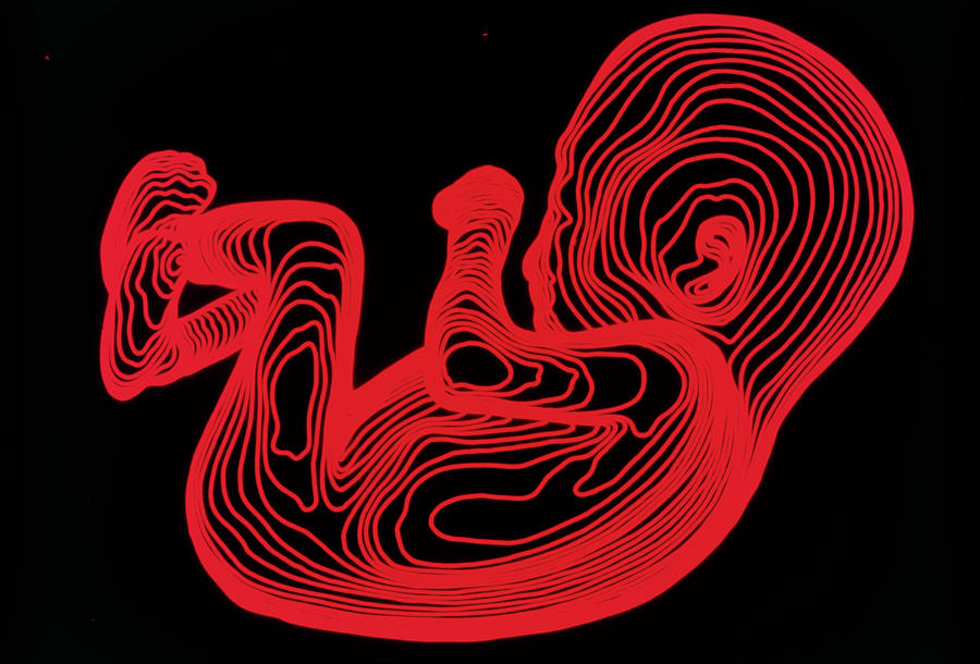 Fetus Photograph - Body Contour Map Of 14 Week Old Foetus by Dr Robin Williams/science Photo Library