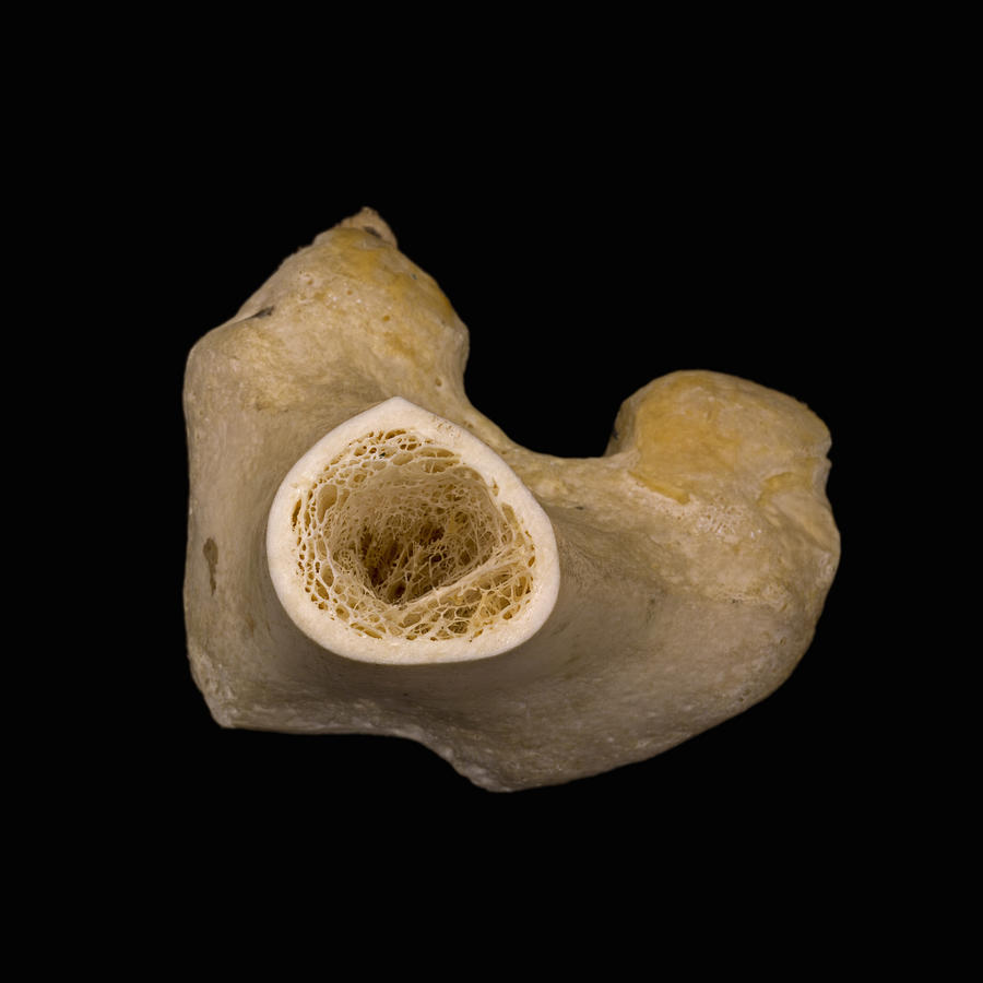 Bone Cross Section, Lm Photograph by Science Stock Photography