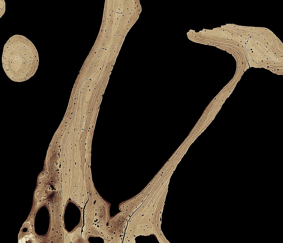 Bone Photograph - Bone Cross-section by Science Photo Library