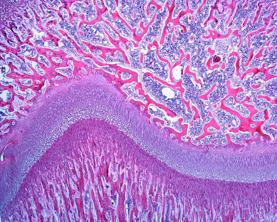 Bone Growth Plate Photograph by Jose Calvo / Science Photo Library Pixels