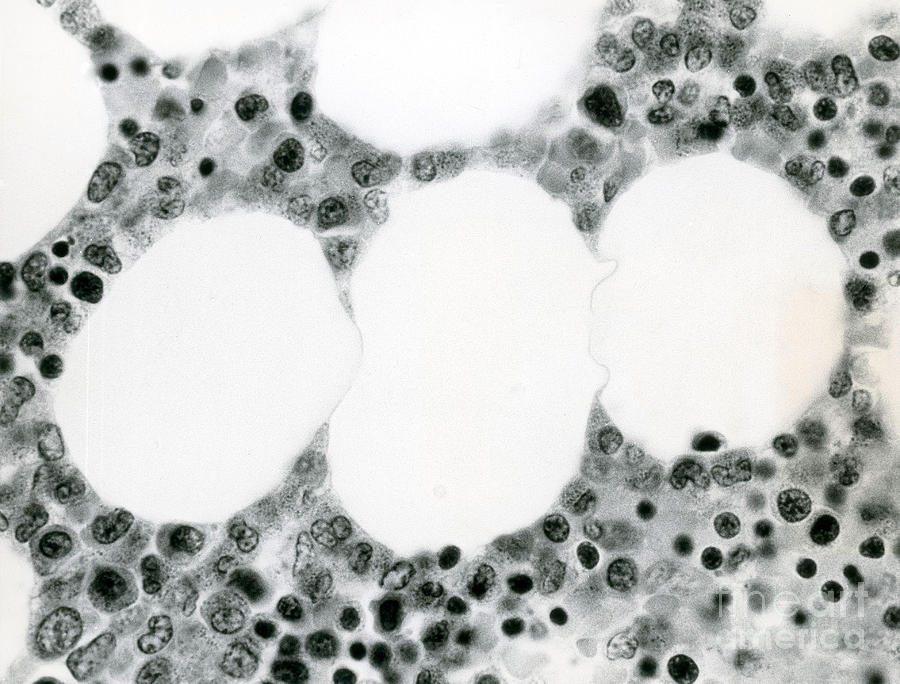 Bone Marrow & Fat Cells, Lm Photograph by David M. Phillips
