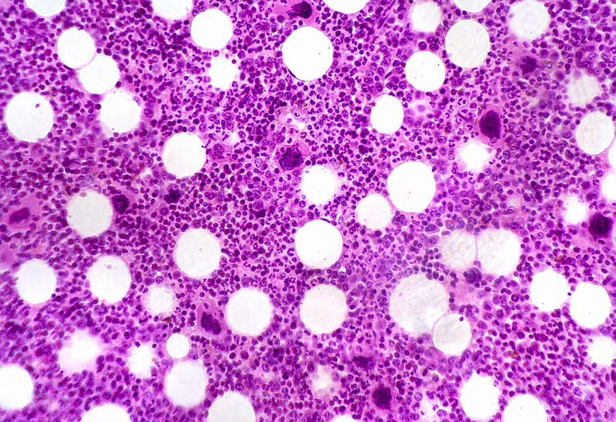 Bone Marrow Section, Lm Photograph by Science Stock Photography