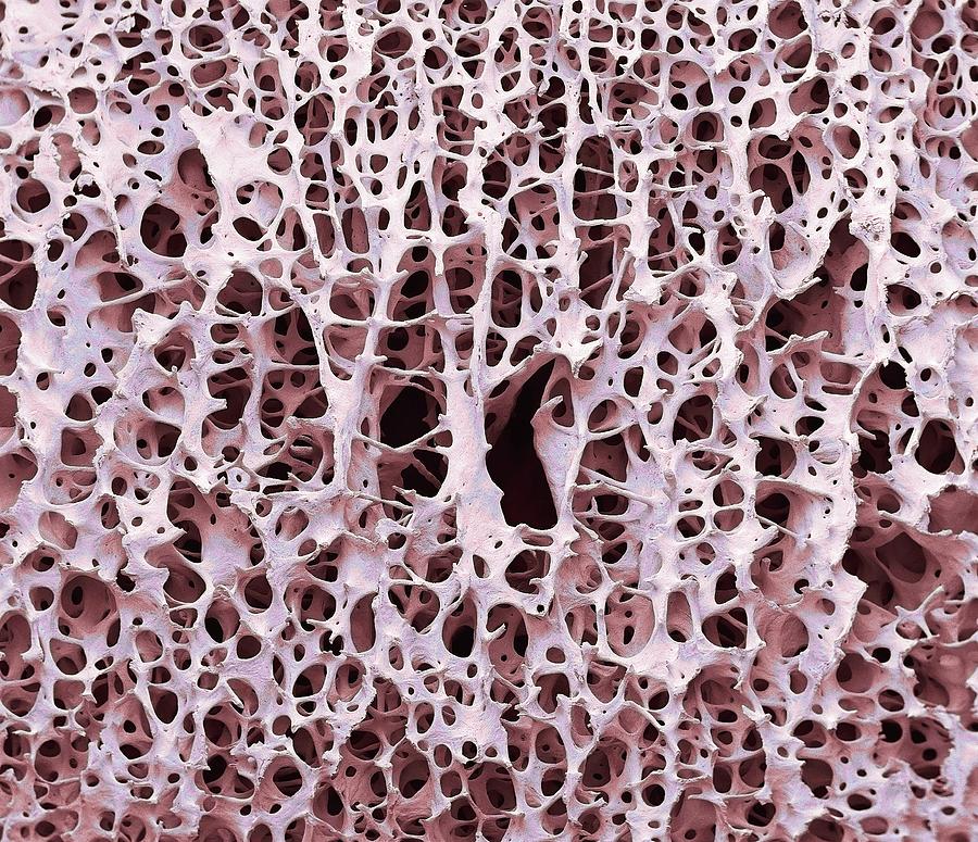 Anatomical Photograph - Bone Tissue by Steve Gschmeissner