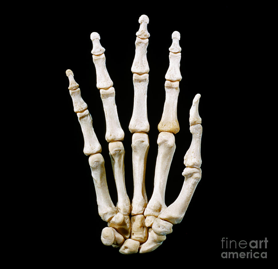 Anatomy Photograph - Bones Of Right Hand, Palmar View by VideoSurgery