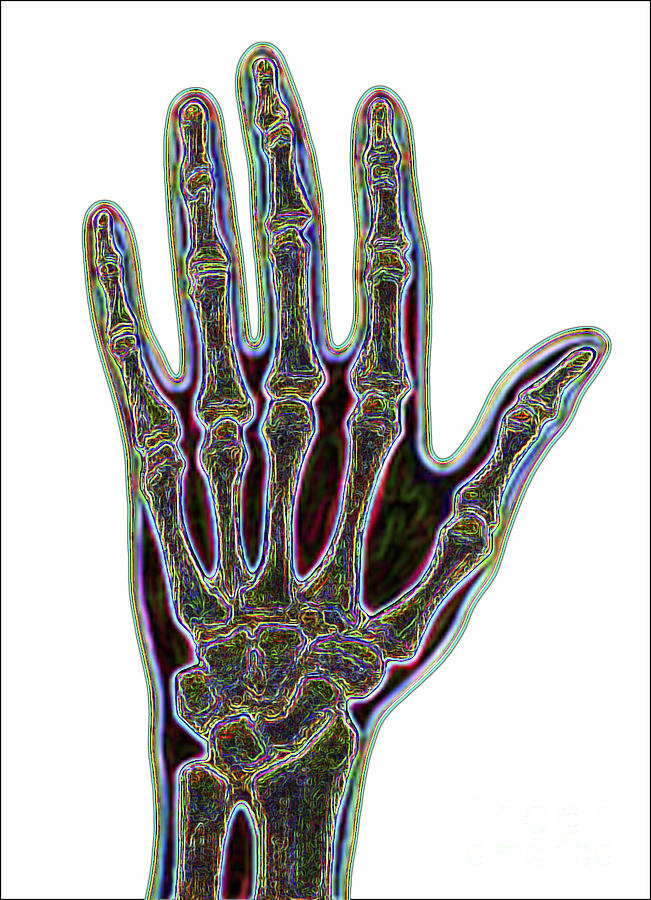 Bones Of The Hand Photograph by Dennis Potokar