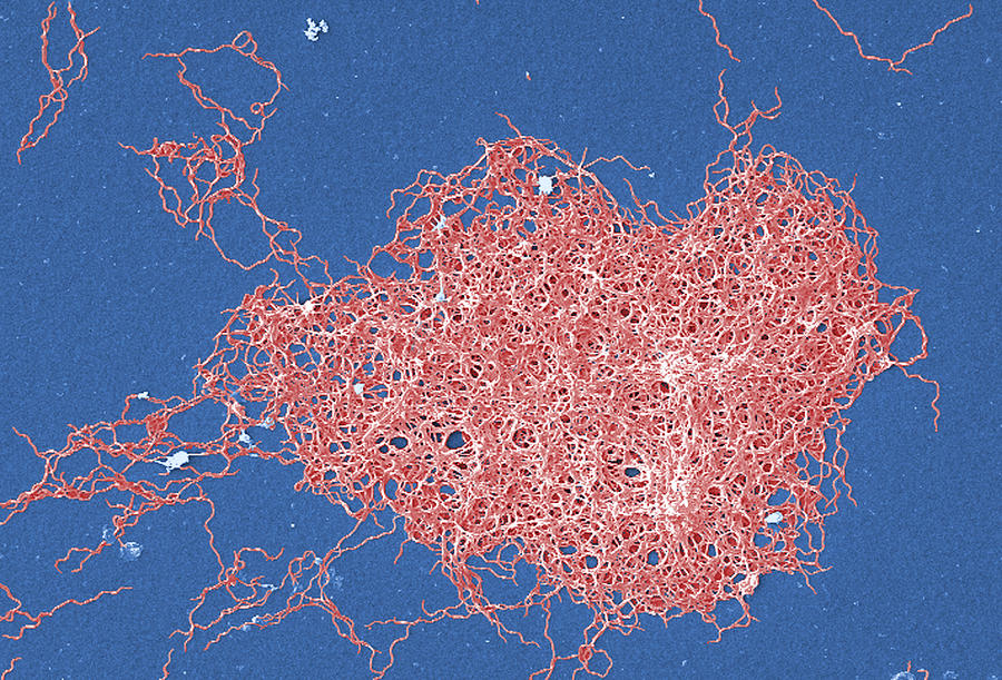 Borrelia Bacteria, Sem Photograph by Science Source