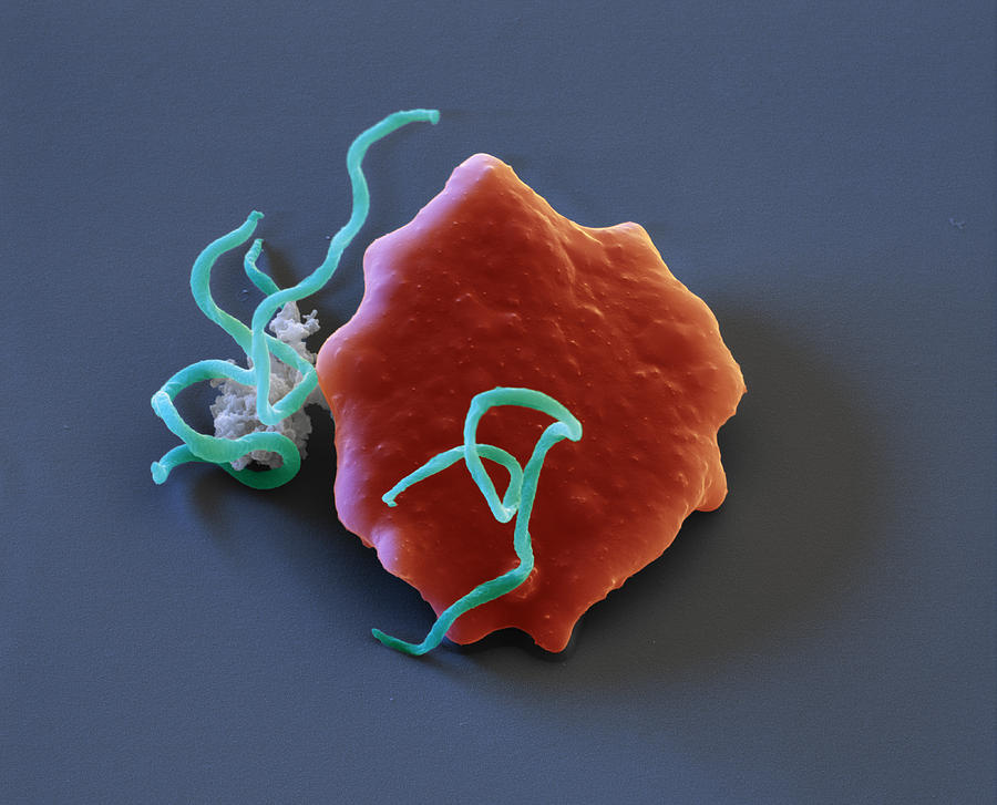 Borrelia Bavariensis And Red Blood Photograph by Eye of Science