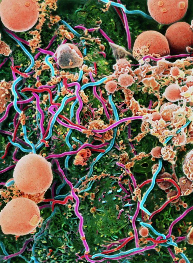 Borrelia Burgdorferi Bacteria In Tick Photograph By National Institute ...