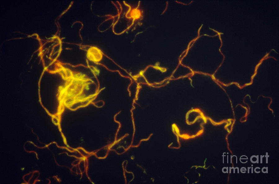 Borrelia Burgdorferi Lm Photograph By David M. Phillips - Fine Art America