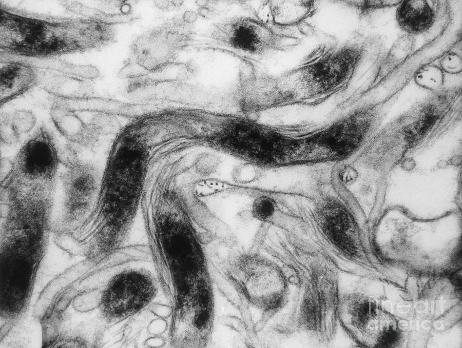 Borrelia Burgdorferi Lyme Disease, Tem Photograph by David M. Phillips