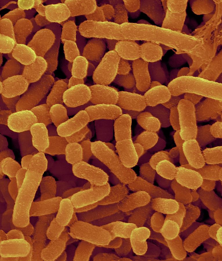 Bovine Rumen Bacterium Photograph by Dennis Kunkel Microscopy/science Photo Library
