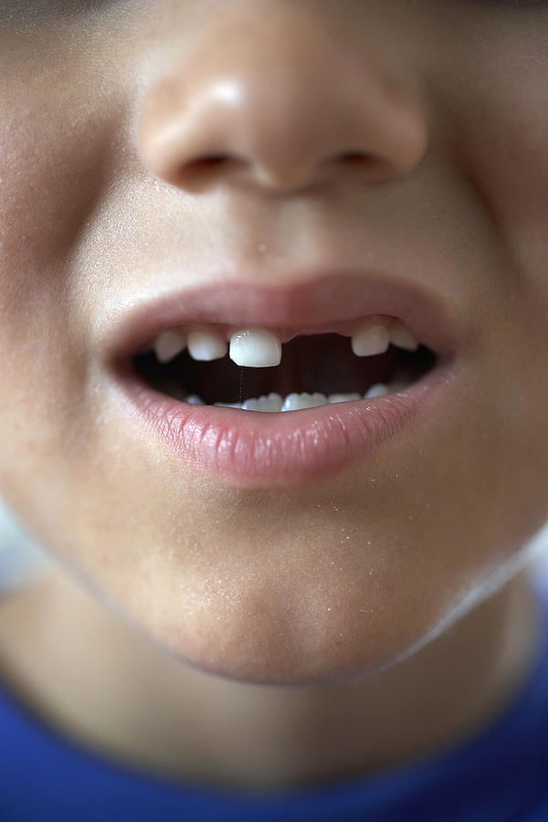 Boy (6-8) with gap in teeth, close-up Photograph by Thomas Northcut